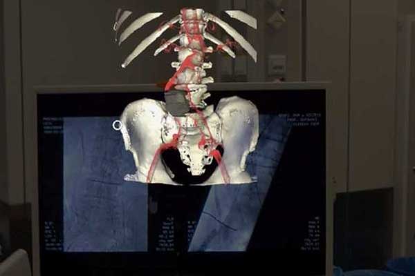 Технологии дополненной реальности в минимально инвазивной хирургии